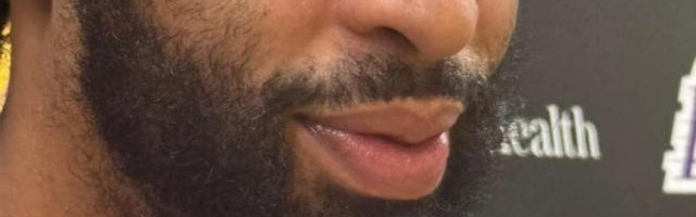 百家乐规则-湖人内线一喜一忧——戴维斯眼部无恙，伍德伤情反复